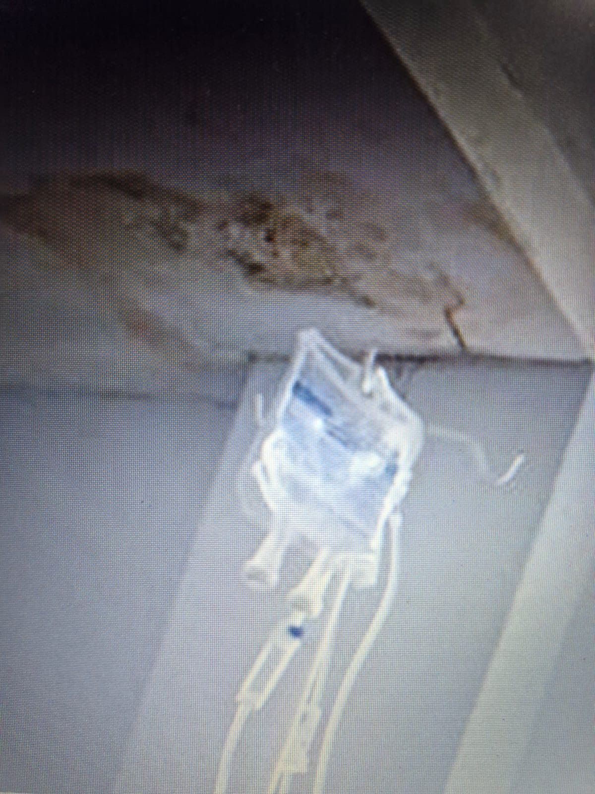 SITUAÇÃO PRECÁRIA EM MUITOS DOS HOSPITAIS PÚBLICOS DE SANTA CATARINA