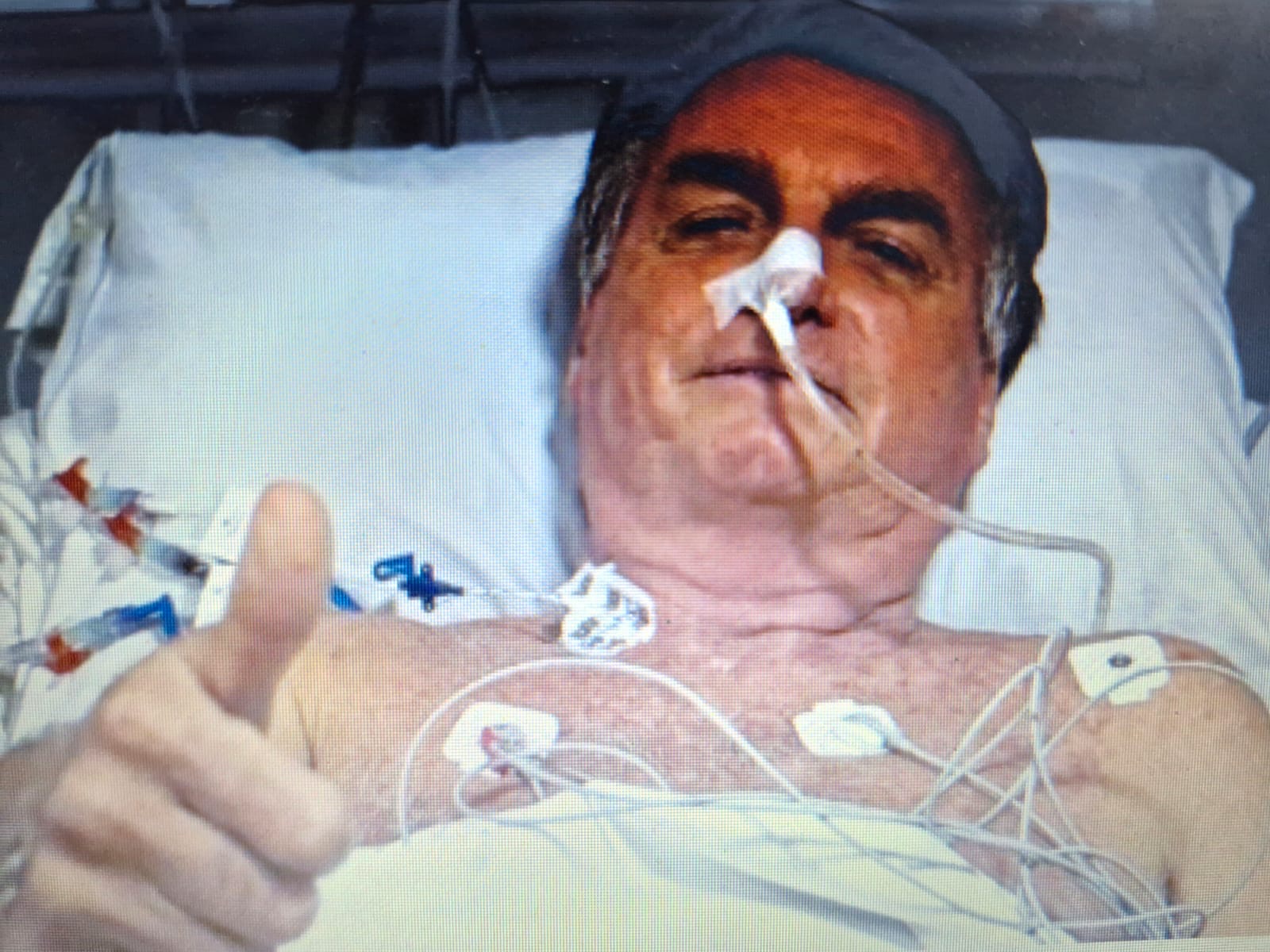 EX-PRESIDENTE BOLSONARO  PASSA MAL, É INTERNADO E PODERÁ PASSAR POR CIRURGIA