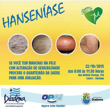 Dia Mundial de Combate à Hanseníase